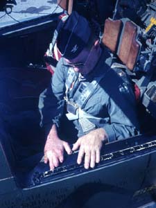 amputated distal joint